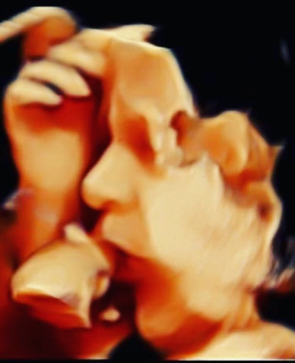 3D ultrasound of a baby&rsquo;s profile with their hand raised