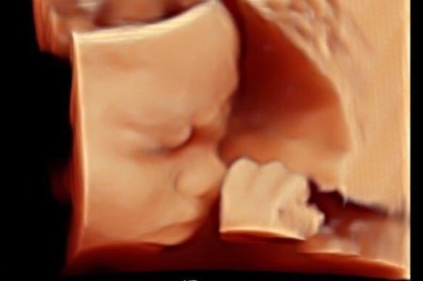 4D ultrasound showing a baby&rsquo;s hand near their face