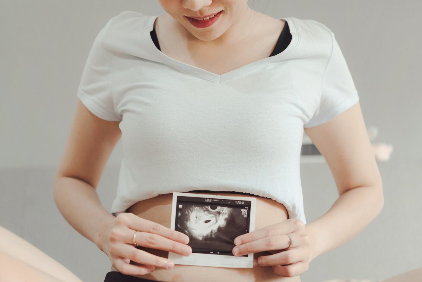 An expectant mother holding an early ultrasound print against her bump