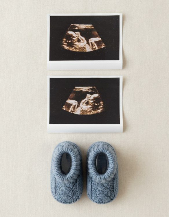 Two ultrasound scan prints on cream linen beside a pair of knitted baby booties