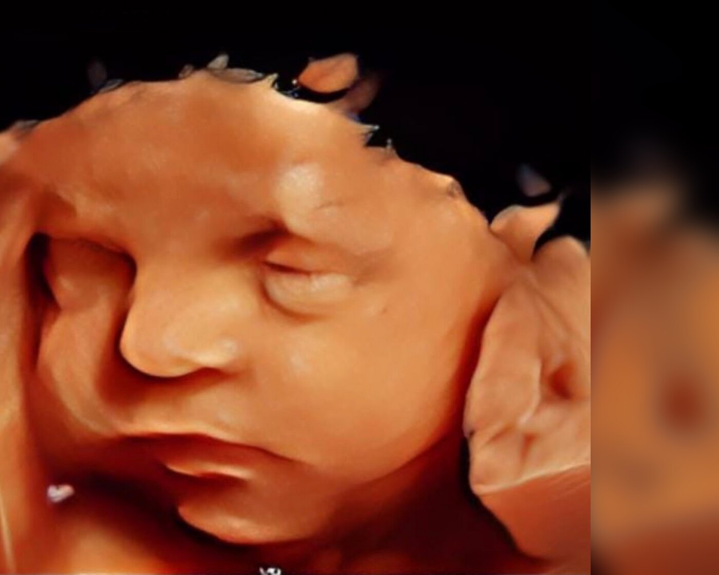 4D ultrasound portrait of a baby&rsquo;s face, eyes closed with a hand resting beside the cheek, captured at UBM Scans