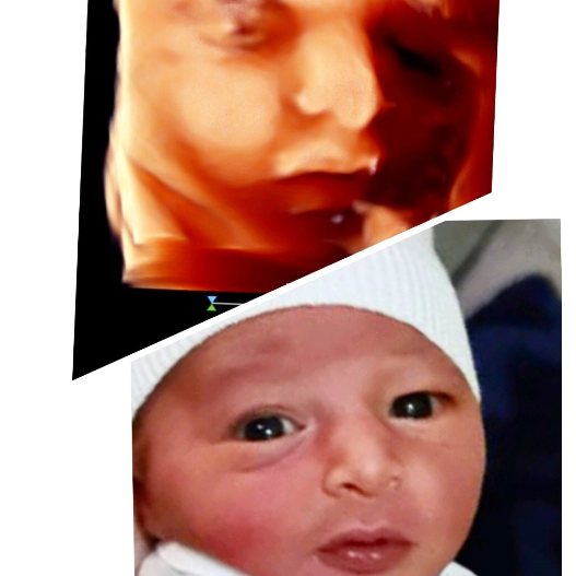A 3D scan image beside a photograph of the newborn baby
