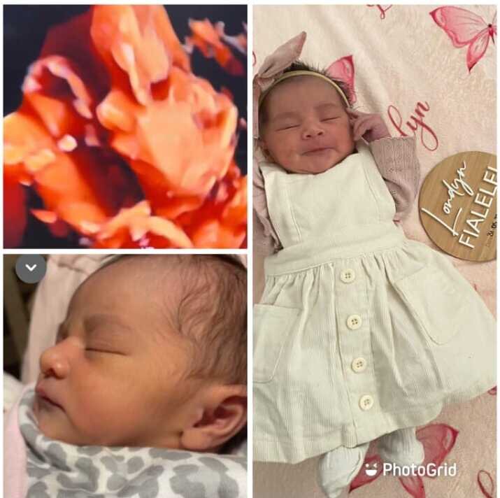 A 3D ultrasound scan alongside photographs of the same baby after birth